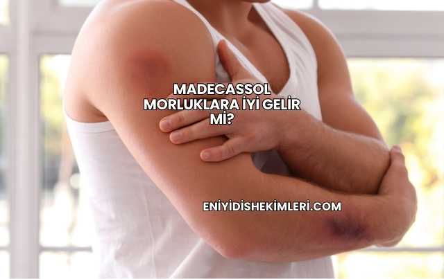Madecassol Morluklara İyi Gelir mi?