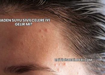 Maden Suyu Sivilcelere İyi Gelir mi?