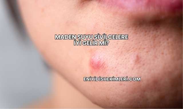 Maden Suyu Sivilcelere İyi Gelir mi?