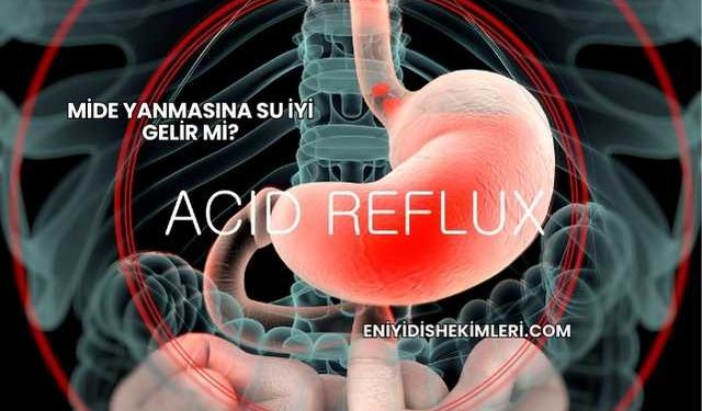 Mide Yanmasına Su İyi Gelir mi?