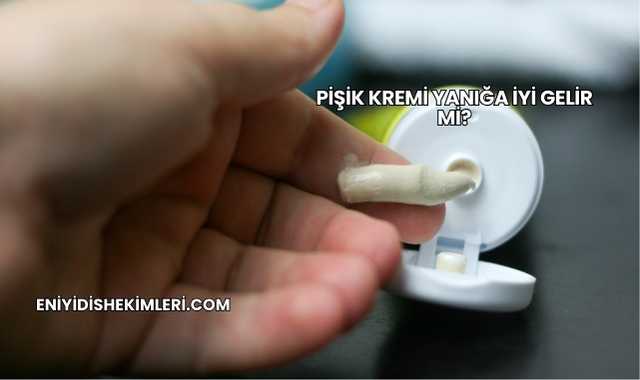 Pişik Kremi Yanığa İyi Gelir mi?