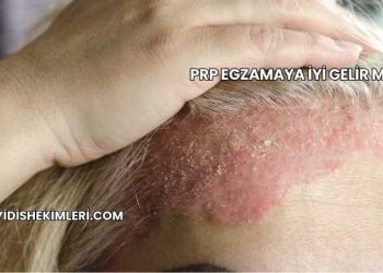 Prp Egzamaya İyi Gelir mi?
