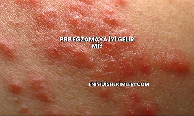 Prp Egzamaya İyi Gelir mi?