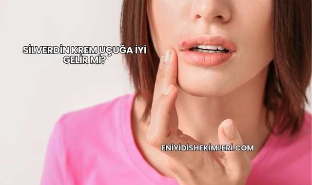 Silverdin Krem Uçuğa İyi Gelir mi?