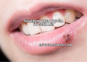 Silverdin Krem Uçuğa İyi Gelir mi?