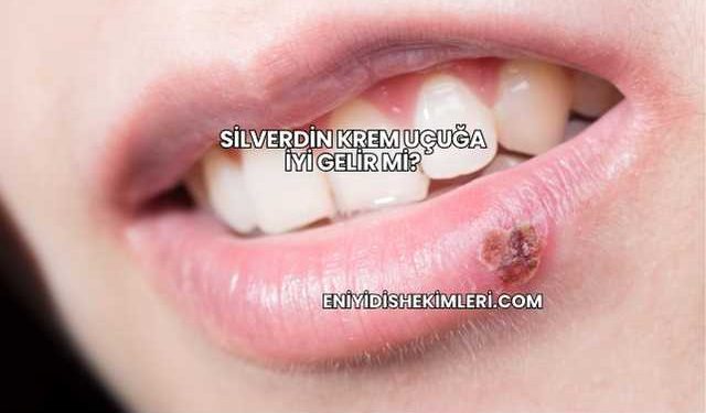 Silverdin Krem Uçuğa İyi Gelir mi?