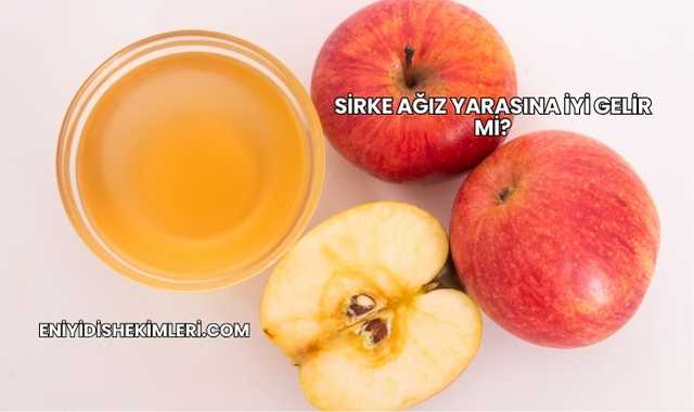 Sirke Ağız Yarasına İyi Gelir mi?