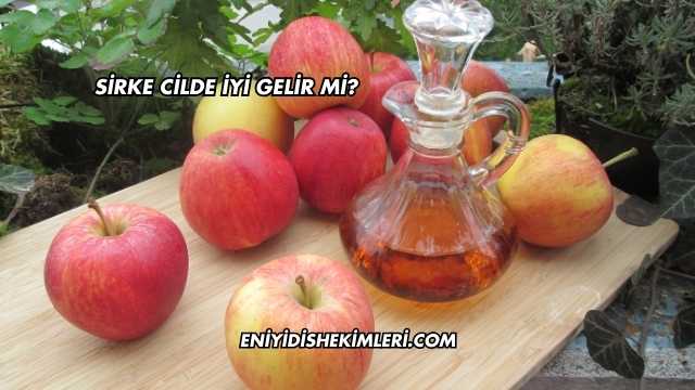 Sirke Cilde İyi Gelir mi?