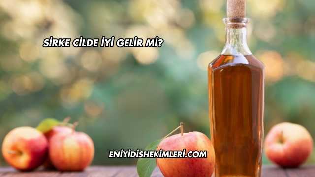 Sirke Cilde İyi Gelir mi?