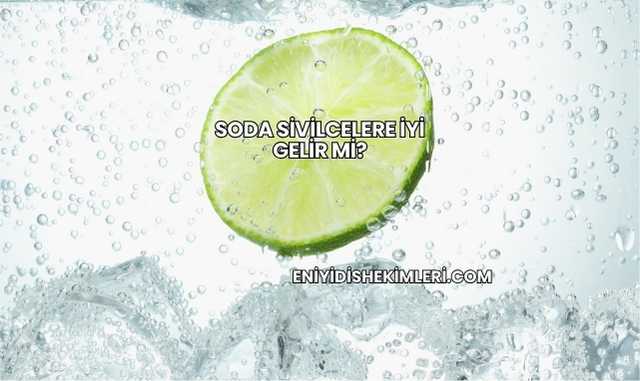 Soda Sivilcelere İyi Gelir mi?