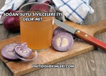 Soğan Suyu Sivilcelere İyi Gelir mi?