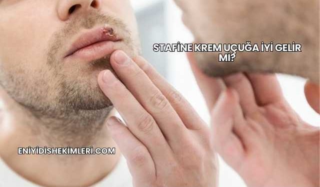 Stafine Krem Uçuğa İyi Gelir mi?
