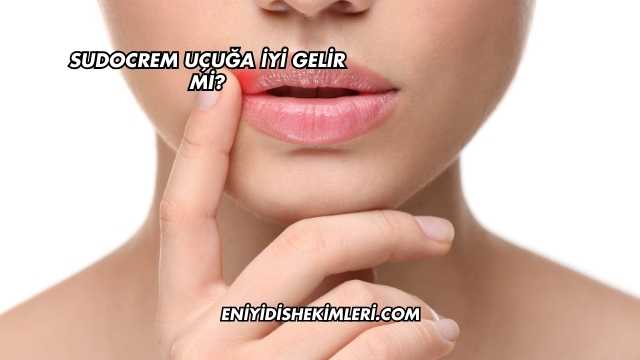 Sudocrem Uçuğa İyi Gelir mi?