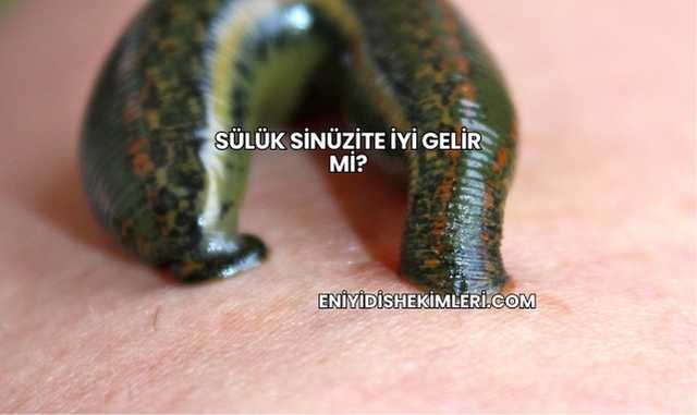 Sülük Sinüzite İyi Gelir mi?