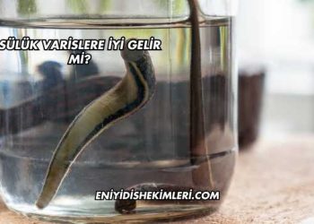 Sülük Varislere İyi Gelir mi?