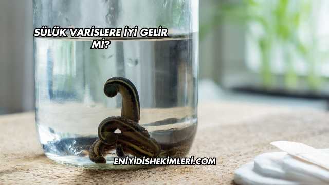 Sülük Varislere İyi Gelir mi?