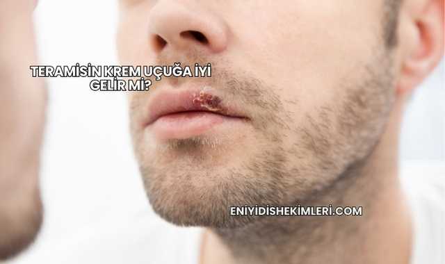 Teramisin Krem Uçuğa İyi Gelir mi?