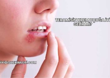 Teramisin Krem Uçuğa İyi Gelir mi?