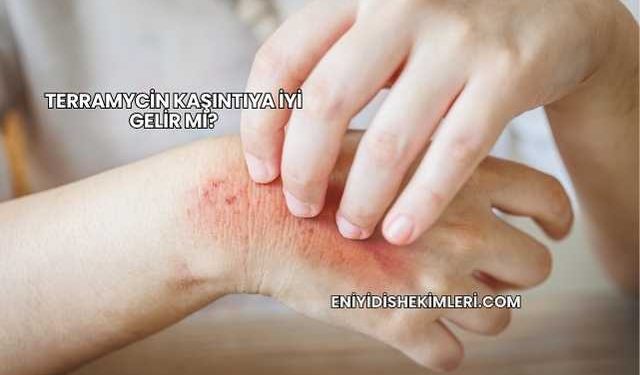 Terramycin Kaşıntıya İyi Gelir mi?