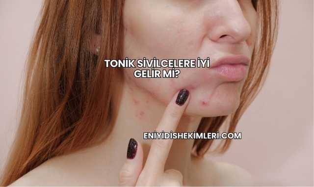 Tonik Sivilcelere İyi Gelir mi?
