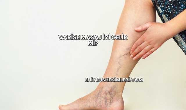 Varise Masaj İyi Gelir mi?