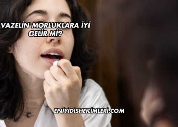 Vazelin Morluklara İyi Gelir mi?