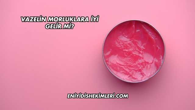 Vazelin Morluklara İyi Gelir mi?