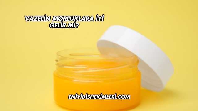 Vazelin Morluklara İyi Gelir mi?
