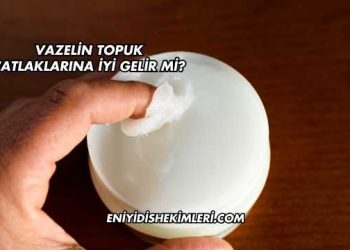 Vazelin Topuk Çatlaklarına İyi Gelir mi?