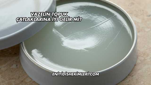 Vazelin Topuk Çatlaklarına İyi Gelir mi?