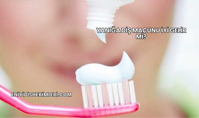 Yanığa Diş Macunu İyi Gelir mi?