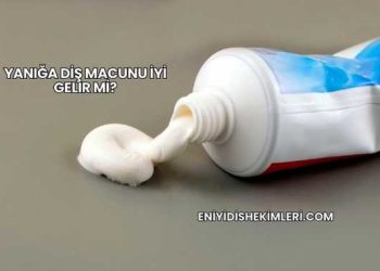 Yanığa Diş Macunu İyi Gelir mi?