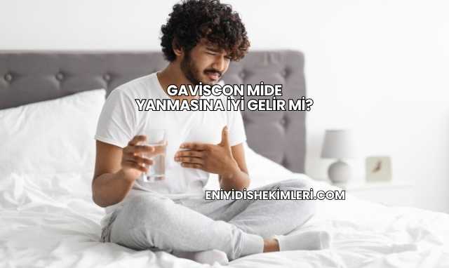 Gaviscon Mide Yanmasına İyi Gelir mi?