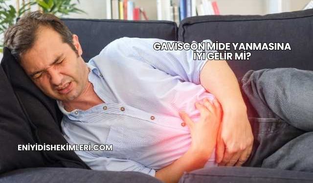 Gaviscon Mide Yanmasına İyi Gelir mi?