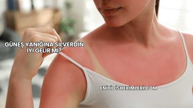 Güneş Yanığına Silverdin İyi Gelir mi?