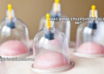 Hacamat Epilepsiye İyi Gelir mi?