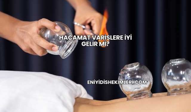 Hacamat Varislere İyi Gelir mi?