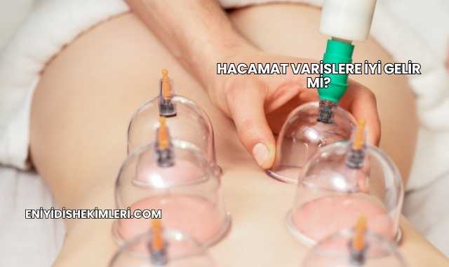 Hacamat Varislere İyi Gelir mi?