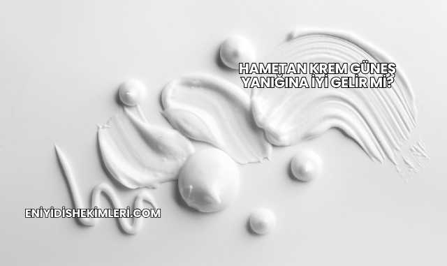 Hametan Krem Güneş Yanığına İyi Gelir mi?