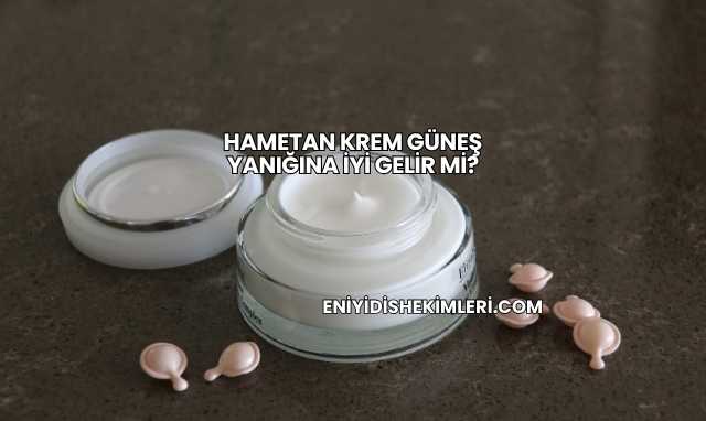 Hametan Krem Güneş Yanığına İyi Gelir mi?
