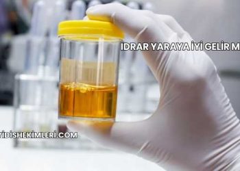 İdrar Yaraya İyi Gelir mi?