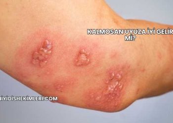 Kalmosan Uyuza İyi Gelir mi?