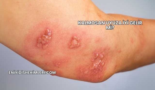 Kalmosan Uyuza İyi Gelir mi?