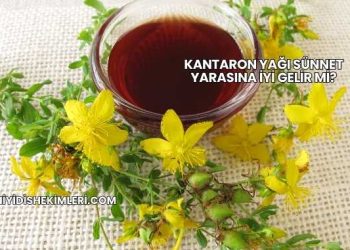Kantaron Yağı Sünnet Yarasına İyi Gelir mi?