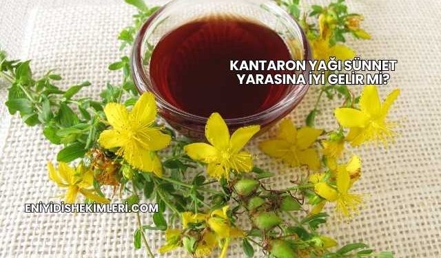 Kantaron Yağı Sünnet Yarasına İyi Gelir mi?