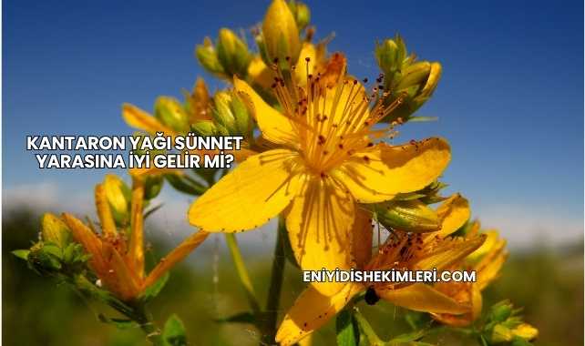 Kantaron Yağı Sünnet Yarasına İyi Gelir mi?