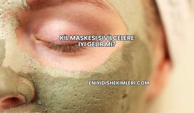 Kil Maskesi Sivilcelere İyi Gelir mi?