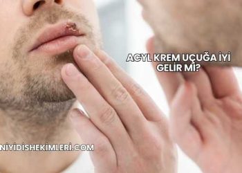 Acyl Krem Uçuğa İyi Gelir mi?