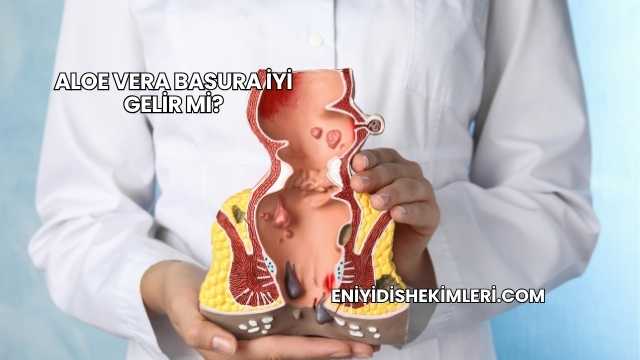 Aloe Vera Basura İyi Gelir mi?