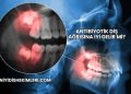 Antibiyotik Diş Ağrısına İyi Gelir mi?